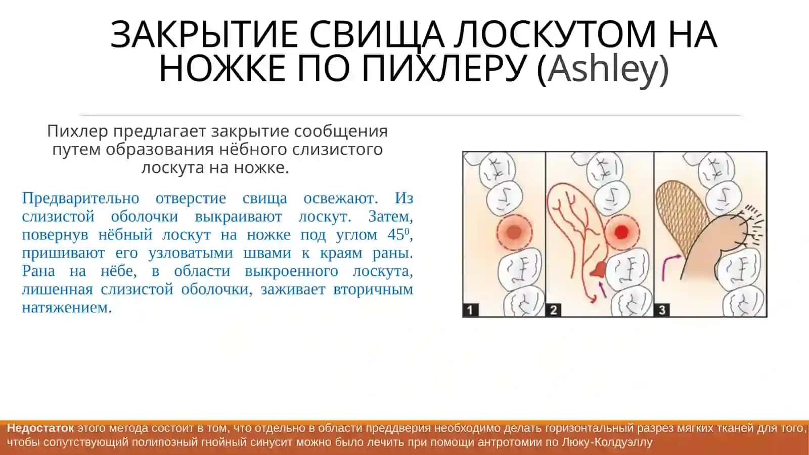 Хирургияда челюсть ёпуқлари юмшатиш усуллари 3