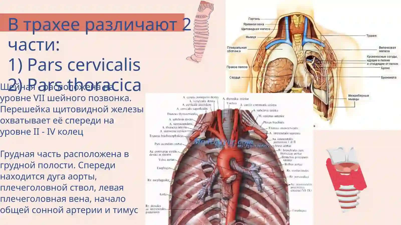 Трахея 3