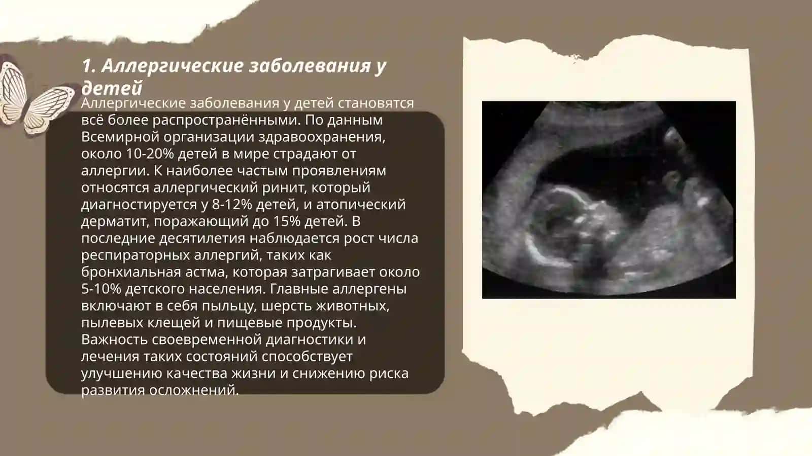 Презентация на тему Современные проблемы детского здоровья 3