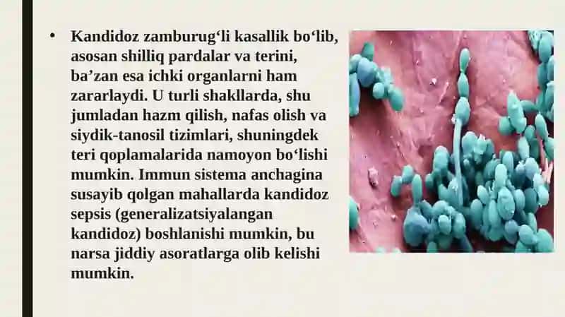 Zamburug' infeksiyalari (Kandidoz va aspirgellez) 3