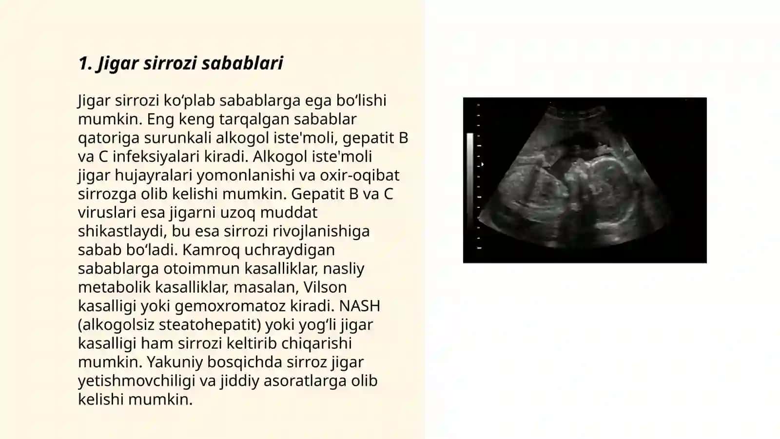 Jigar sirrozi sabablari 3