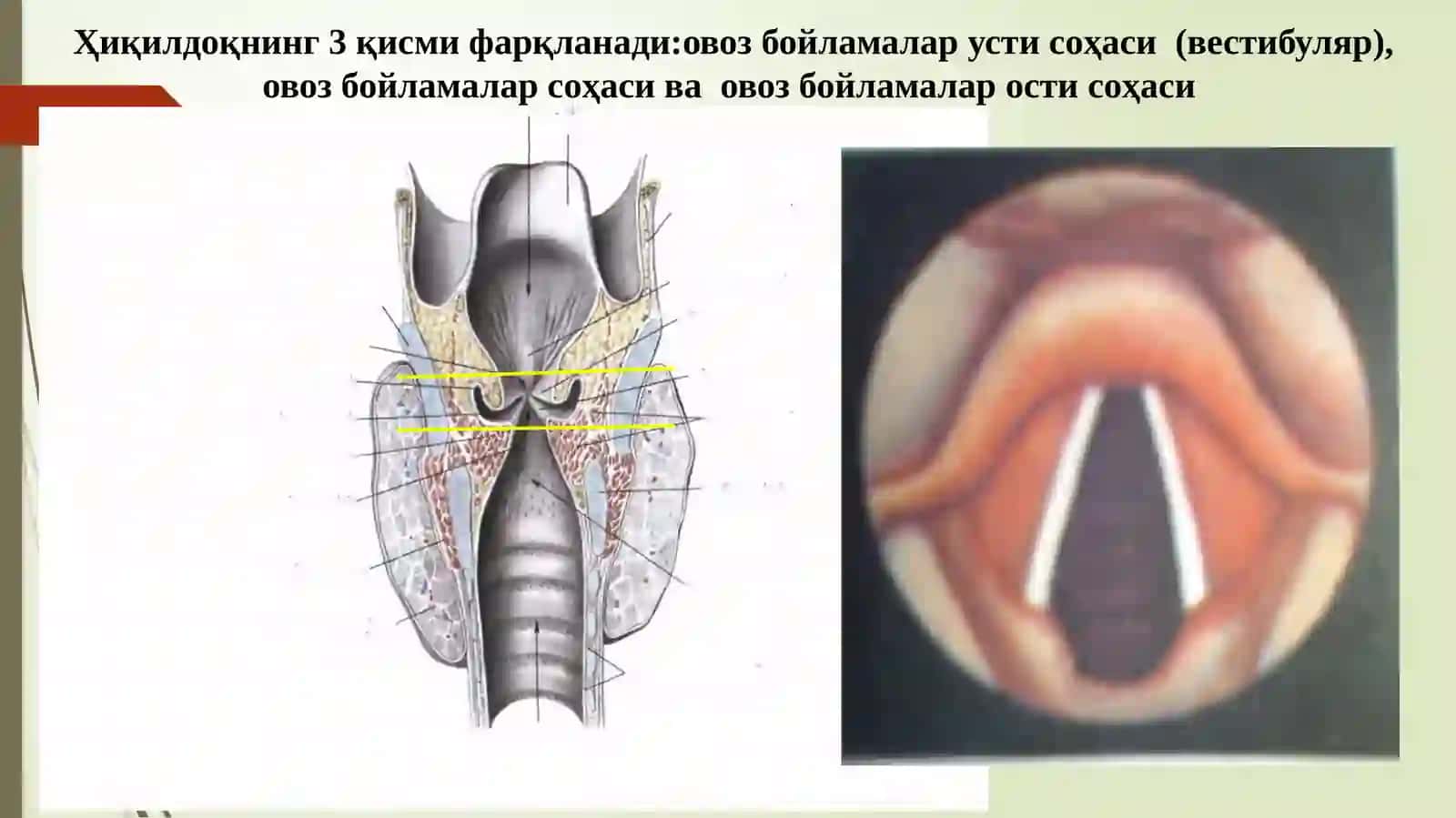 XIQILDOQ RAKI 3