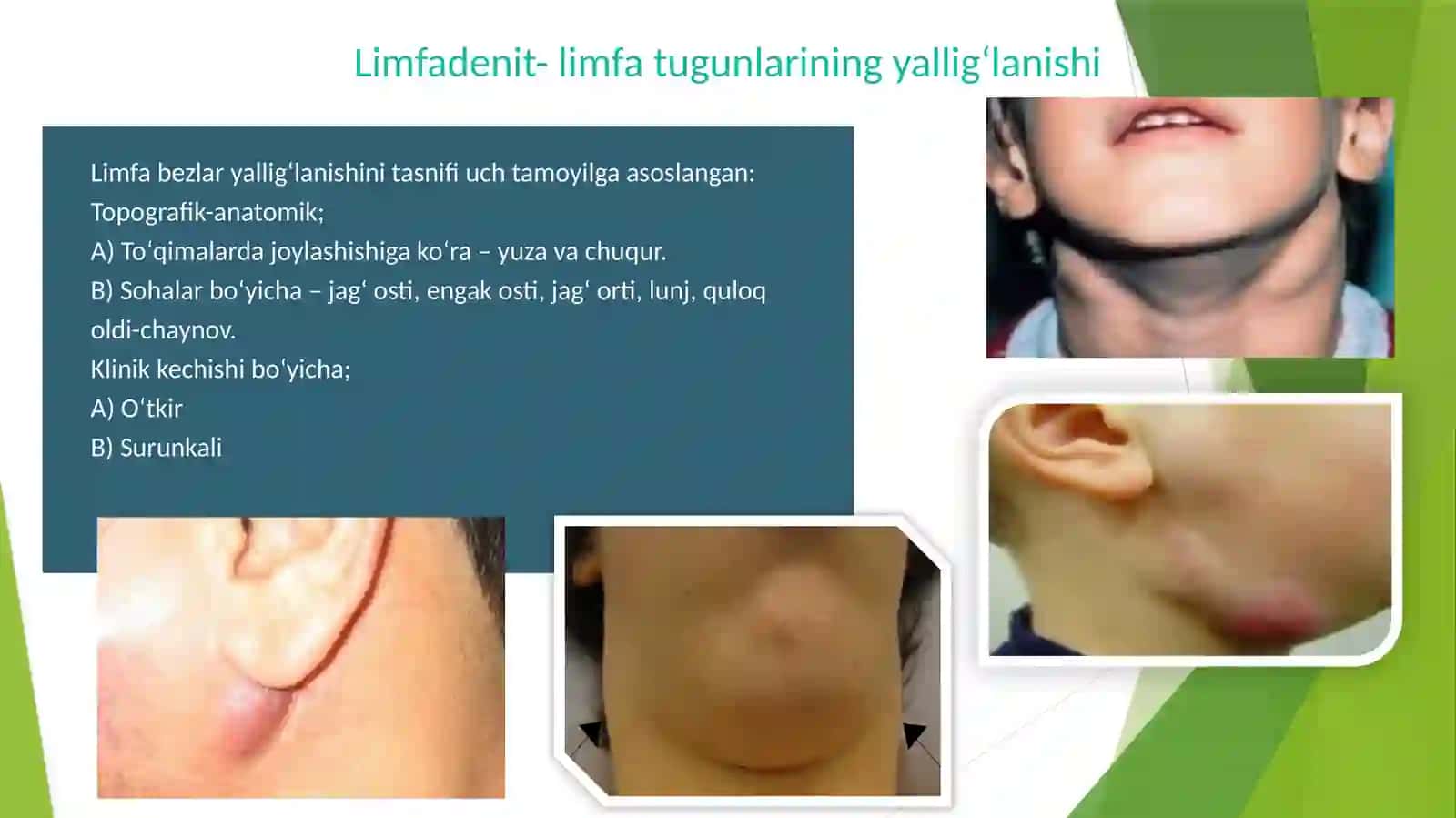 Noodontogen kasalliklar tekshirish 3