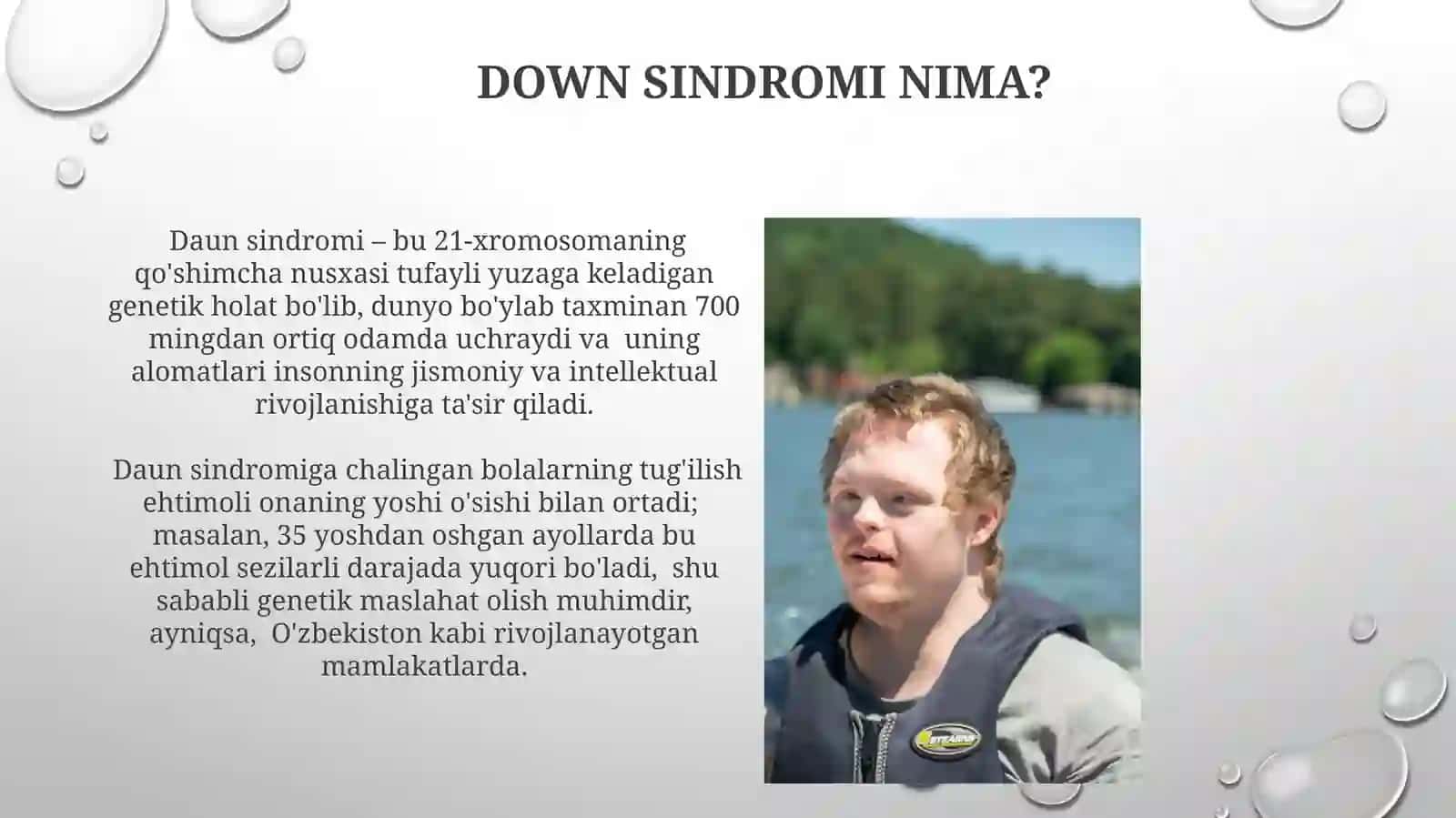 Daunsindromihaqida 3