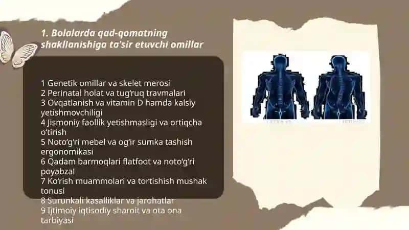 Bolalarda qad-qomatning shakllanishi va kamchiliklari 3
