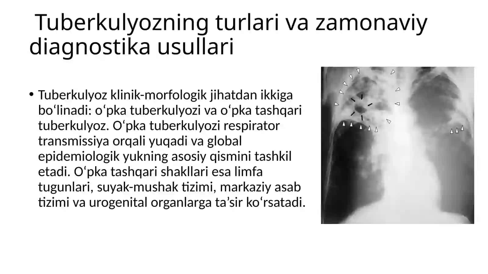 BJSST tavsiyasiga ko'ra tuberkulyoz bemorlarini davolash va kuzatish sxemasi 3