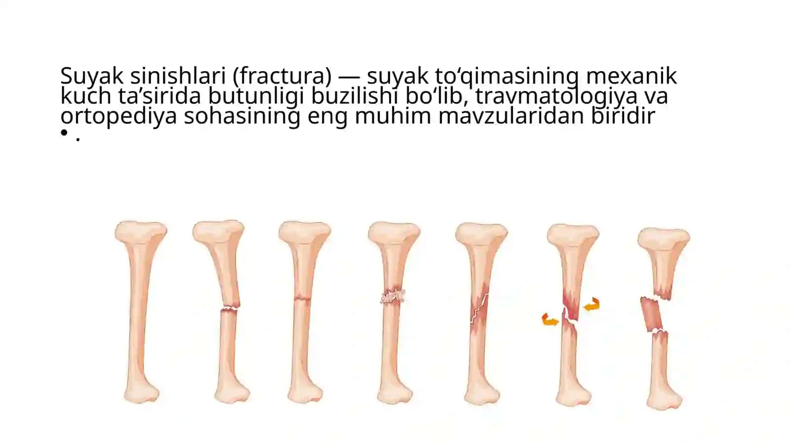SUYAK SINISHLARI 3
