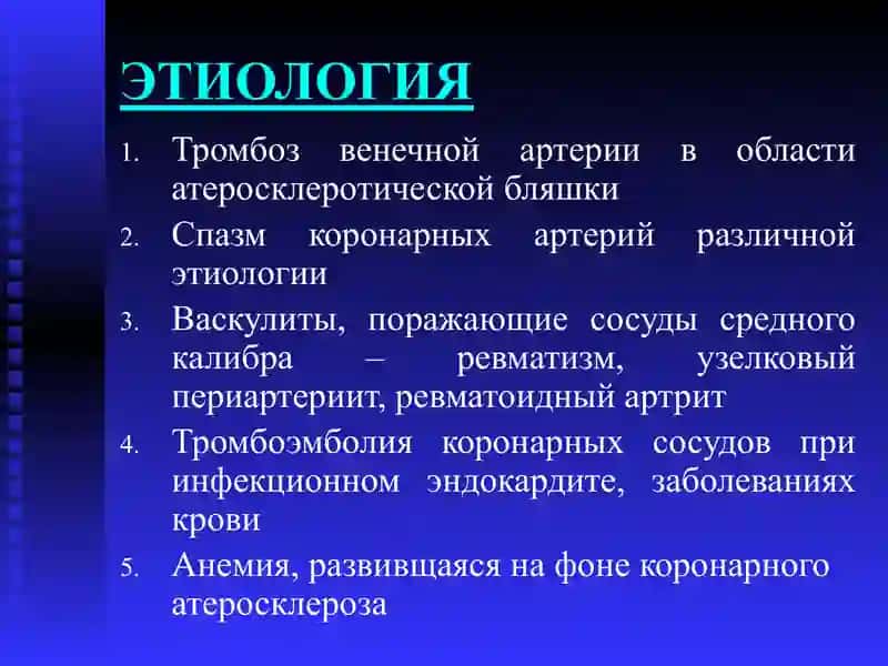 ИНФАРКТ МИОКАРДА 3