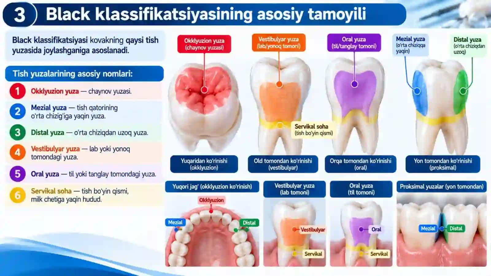 Black klassifikatsiyasi — professional stomatologik taqdimot 3