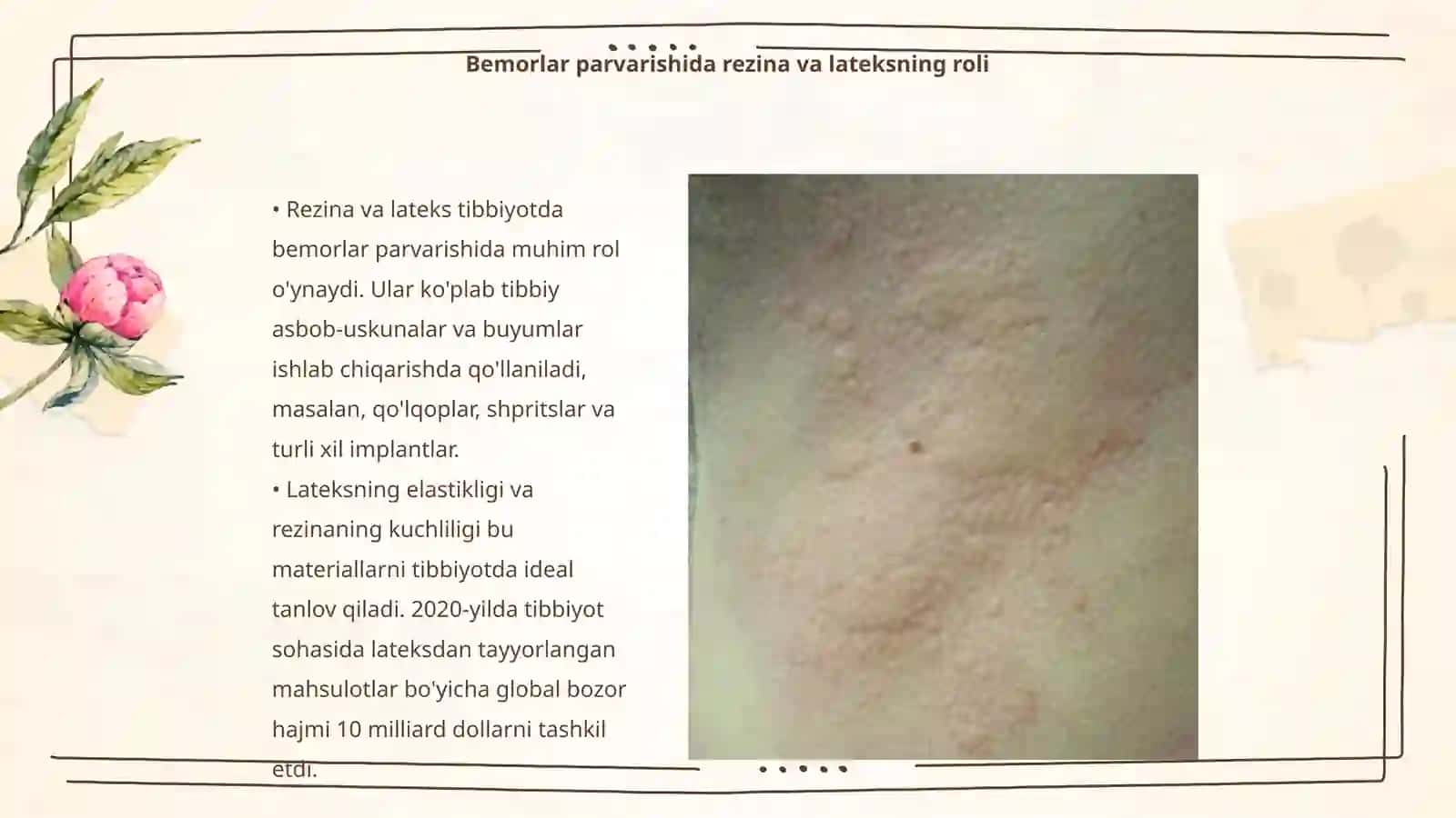 Yangi zamonaviy rezina va lateksdan tayyorlangan tibbiy buyumlar 3