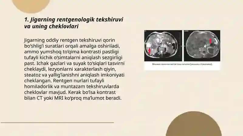 Jigar, o't yo'llari va me'da osti bezining nur tekshiruvi usullari 3