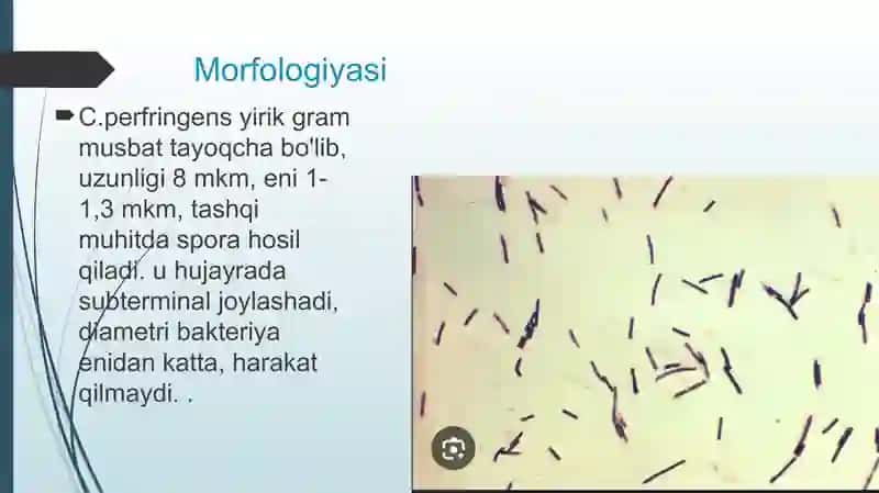 Gazli Gangrena 4