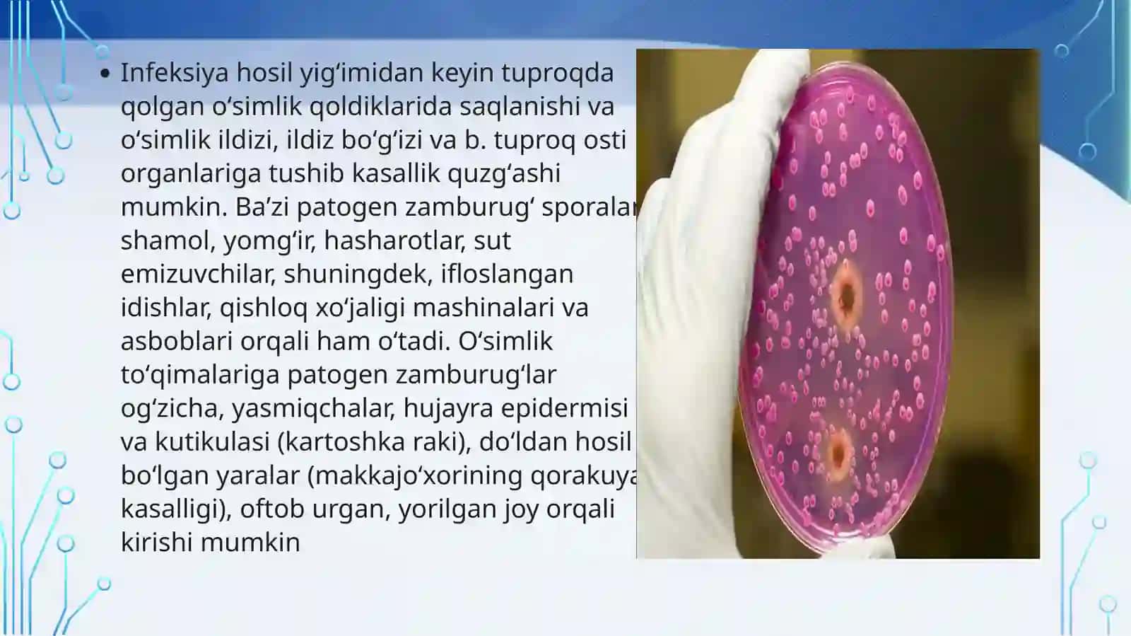 Zamburug’infeksiyalar(kandidoz,aspergilioz) 4