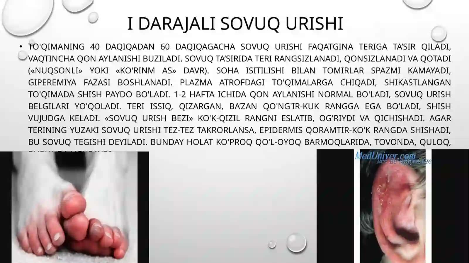 Sovuq urishi 4