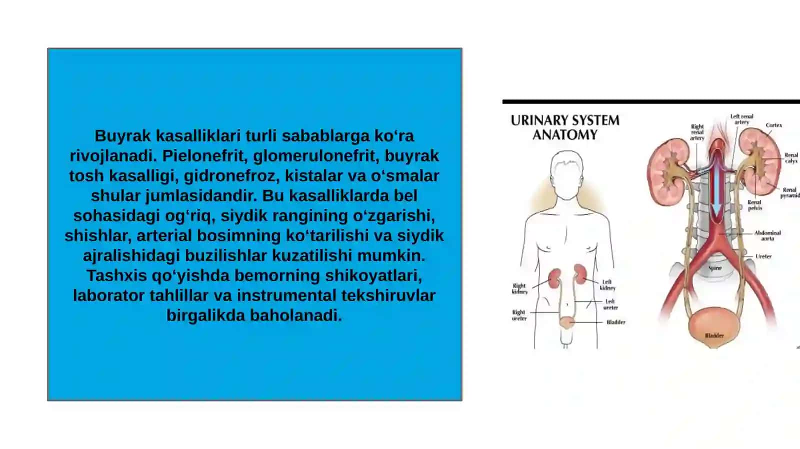 Buyrak kasalliklarini zamonaviy rentgenologik va kompyuterli tomografiya tekshirish usullari 4