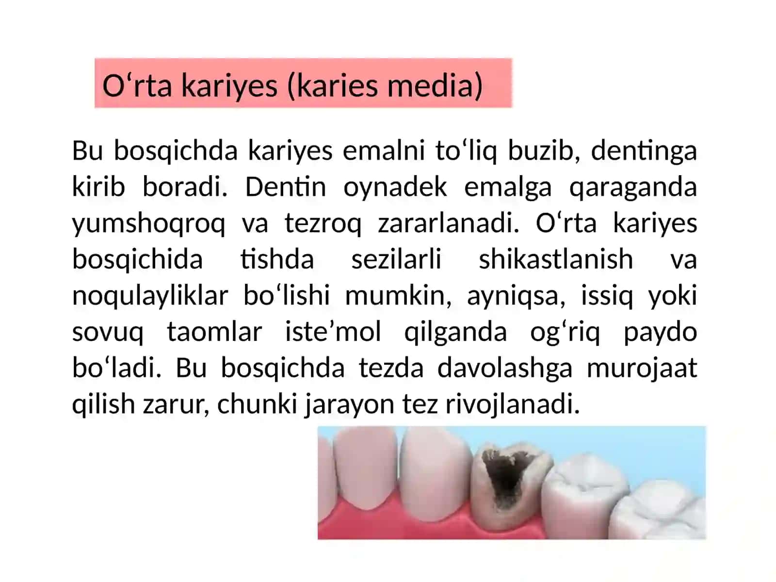 KARIYES 4
