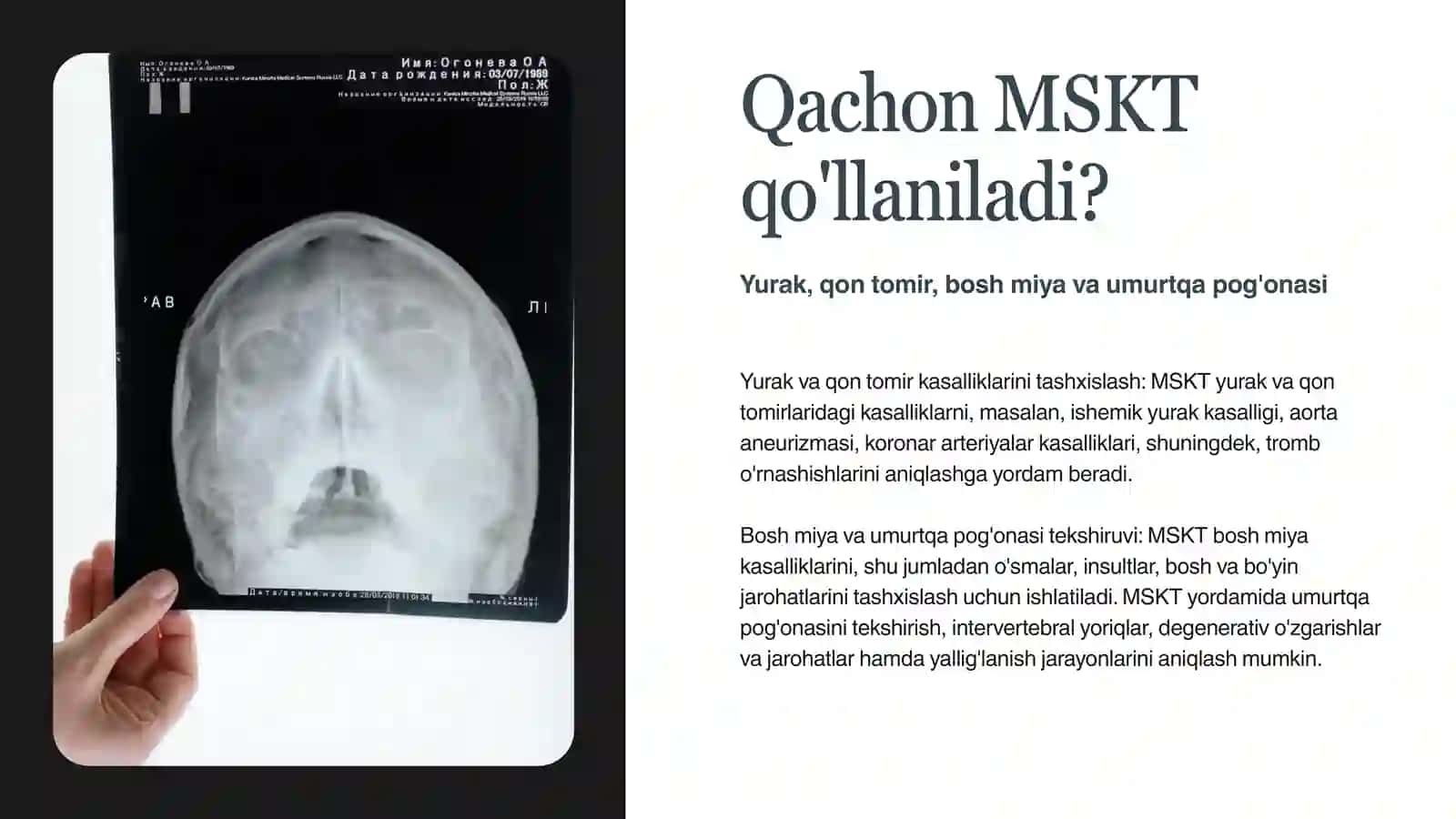 MSKT — Multispiral kompyuter tomografiyasi 4