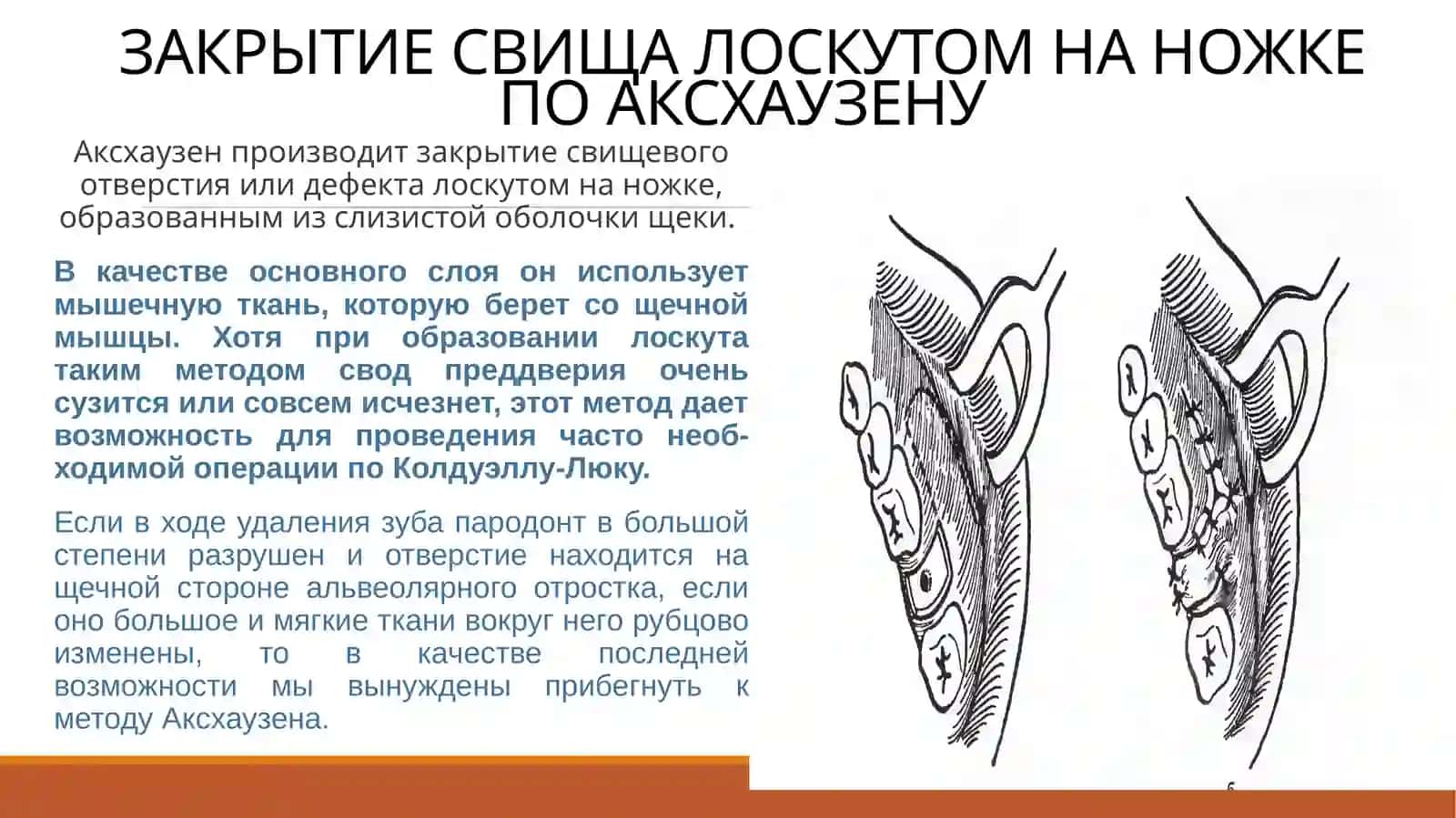 Хирургияда челюсть ёпуқлари юмшатиш усуллари 4