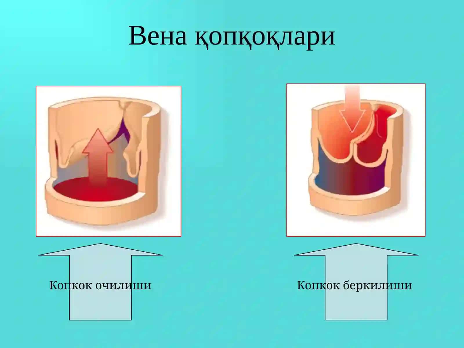 Оёқ веналарининг варикоз касаллиги 4