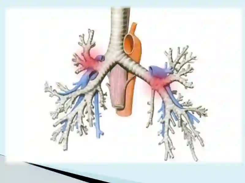 NAFAS ORGANLARINING YOSH HUSUSIYATLARI 4