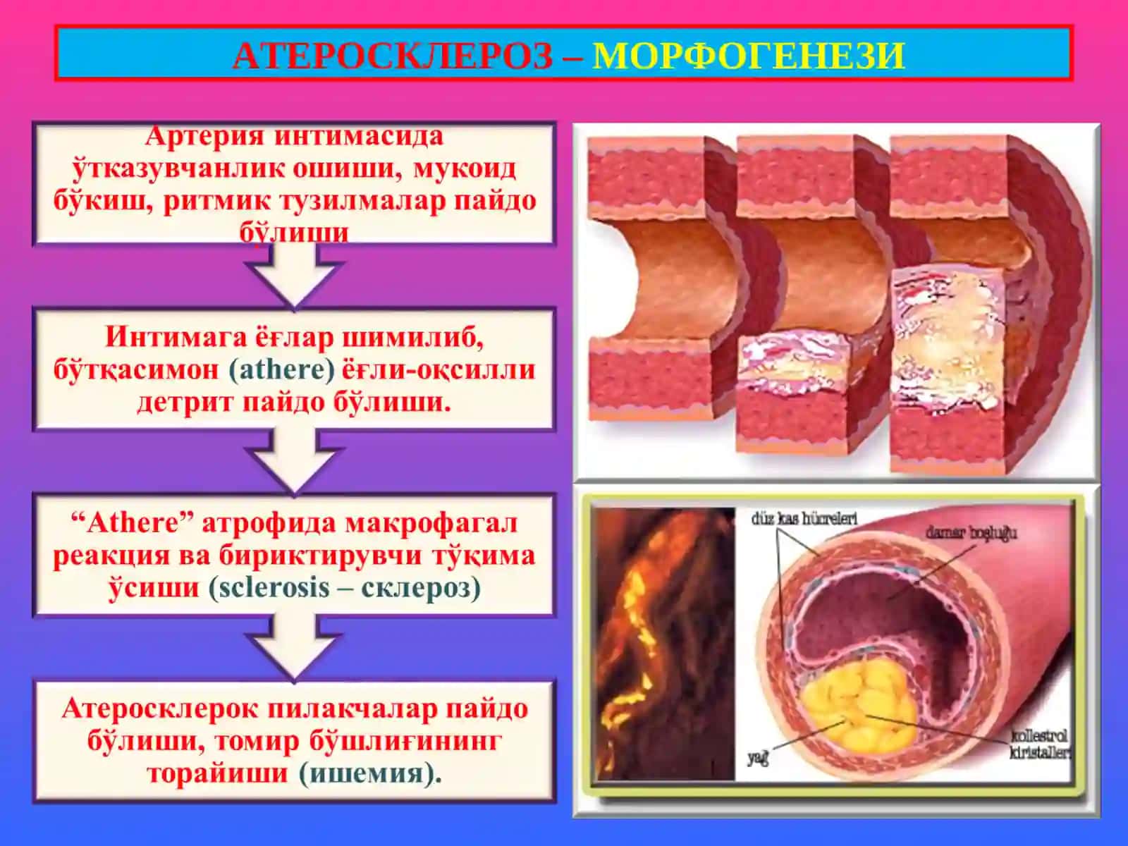 Patologiya tomir kasalliklari 4