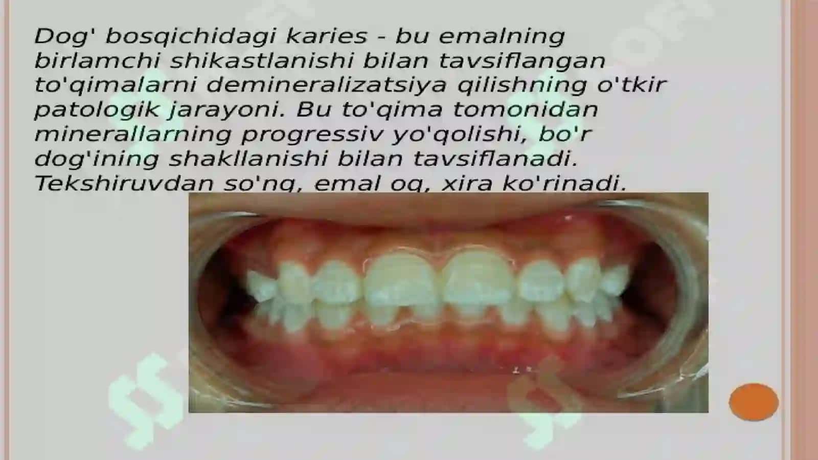 Dog’bosqichida Qiyosiy Taşxiş 4