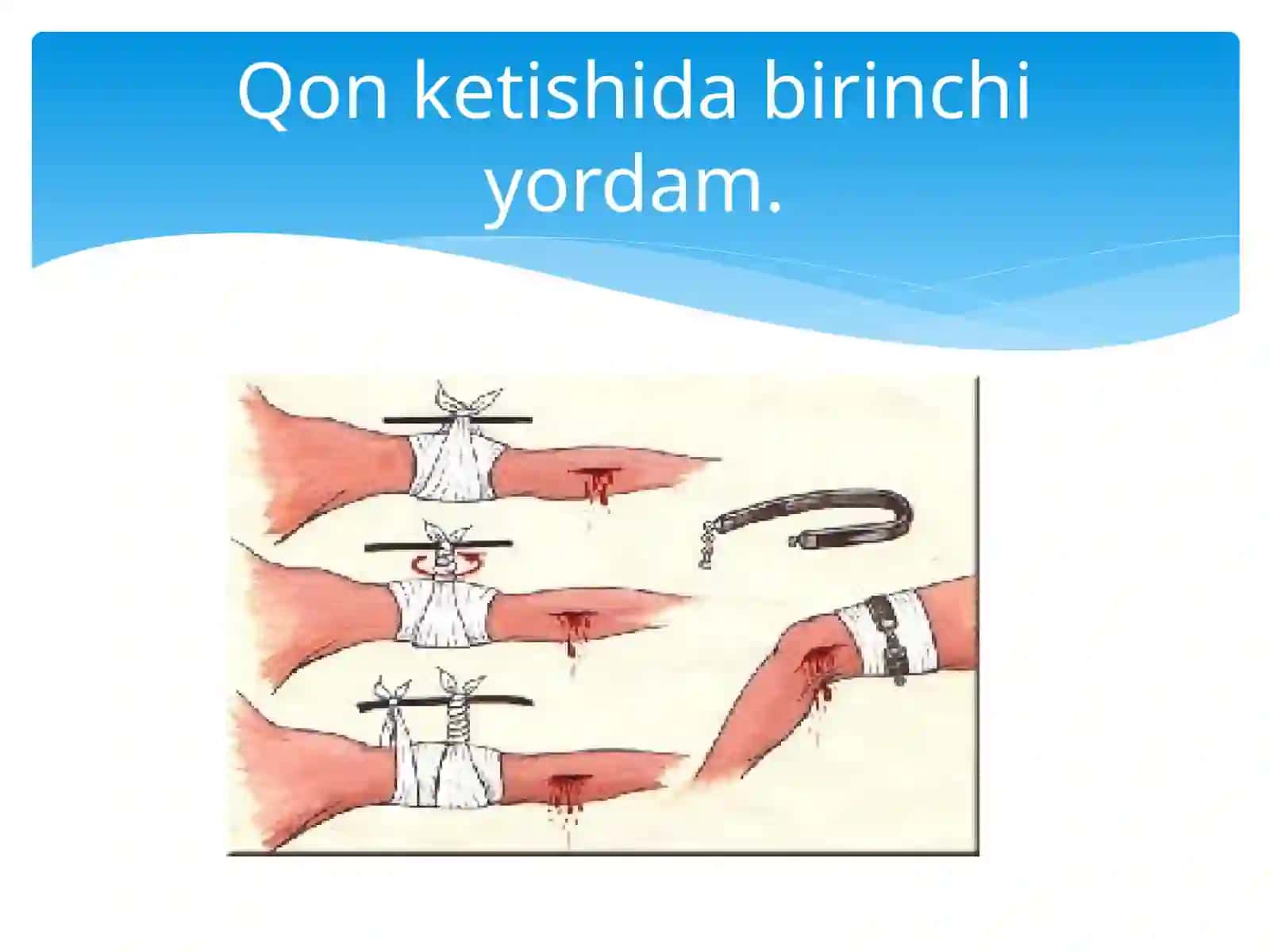 Farg`ona jamoatsalomatligi tibbiyot instituti davolashish fakulteti 2-kurs 16-21 guruhi talabasi Mahammadova Shohsanam 4