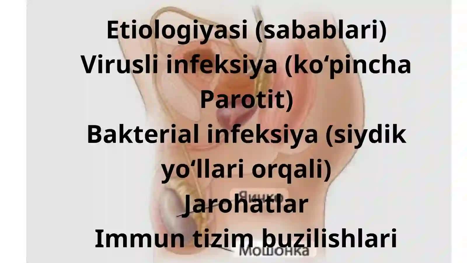 Orxit,prostatit,kriptoxizm 4