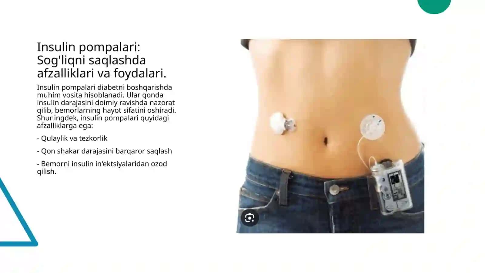 Insulin pompalari va freestyle libre 4