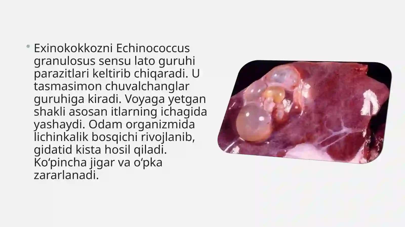 Gelmintozlar:Fan- Yuqumli infekson Kasalliklar 4