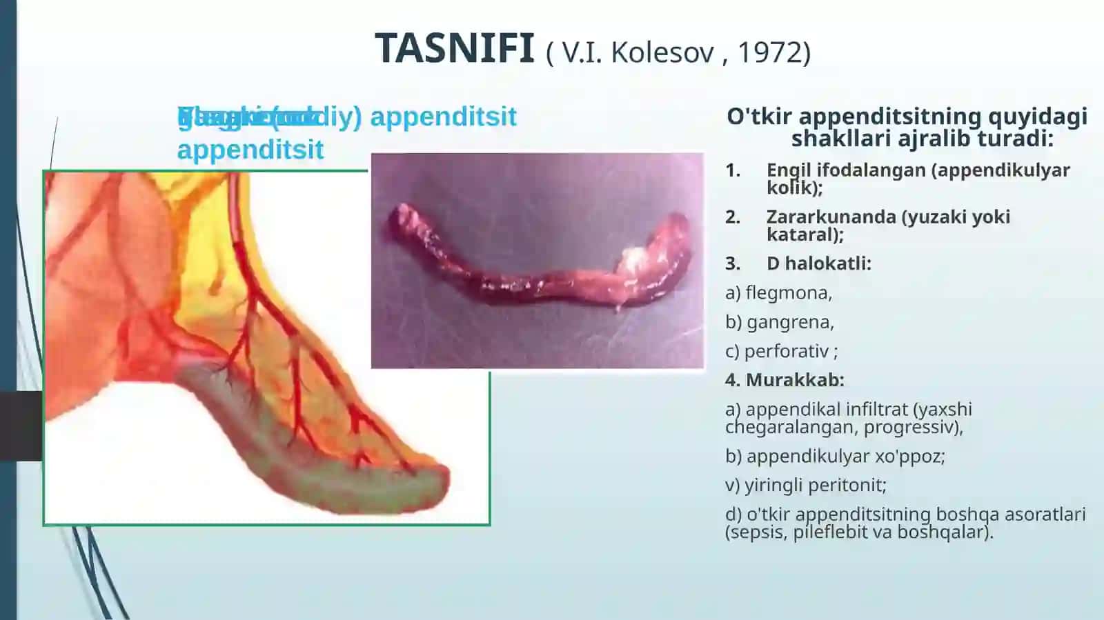 o‘tkir apenditsit 4