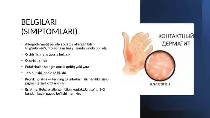 allergiyalar 4