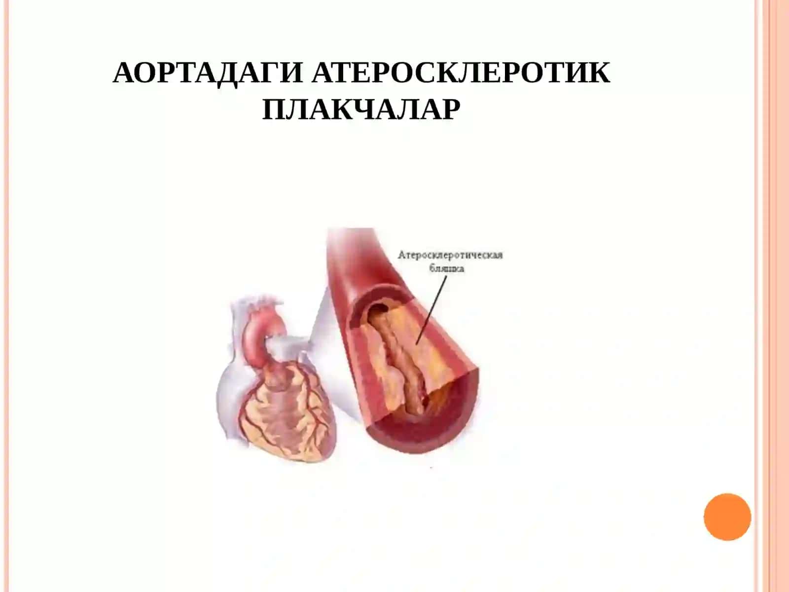 МАЪРУЗА:МИОКАРД ИНФАРКТИ 4