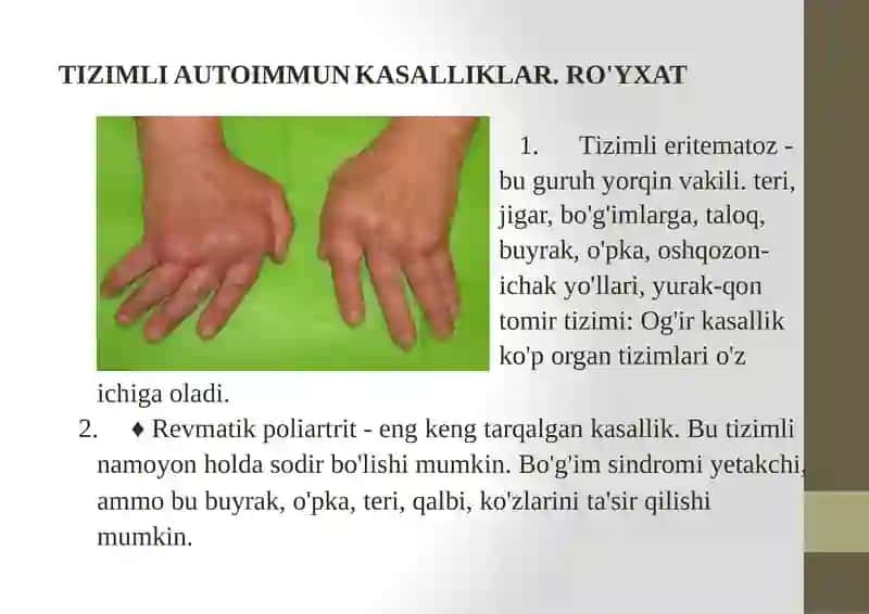 Autoimmunkasalliklar, allergik kasalliklar kelib chiqishi va diagnostikasi 4