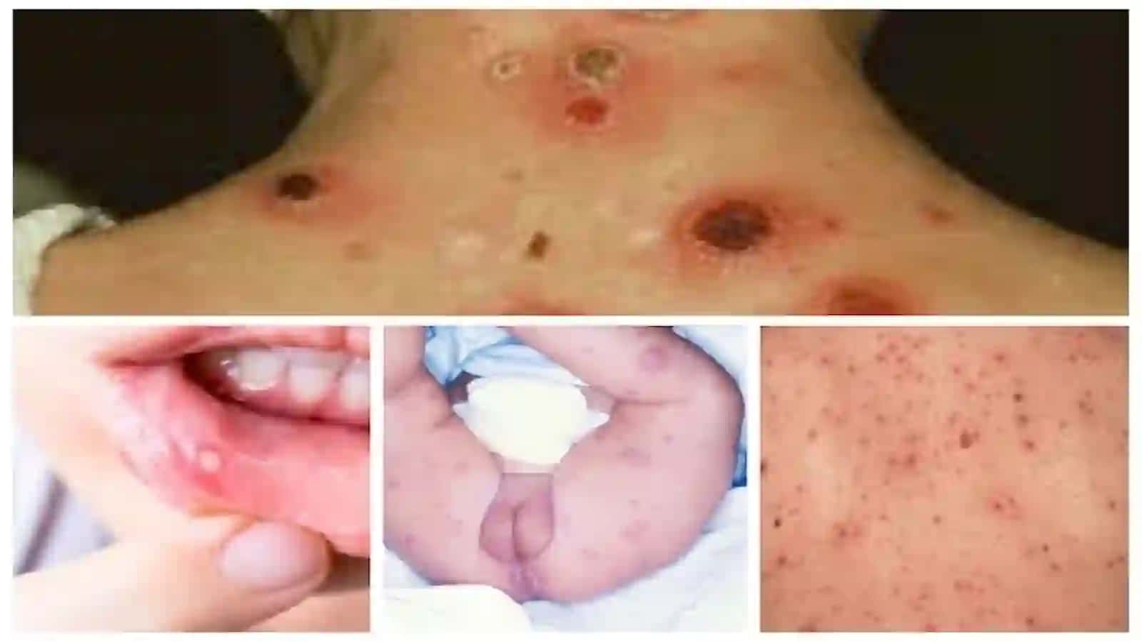 Zaxm Diagnostikasi 4