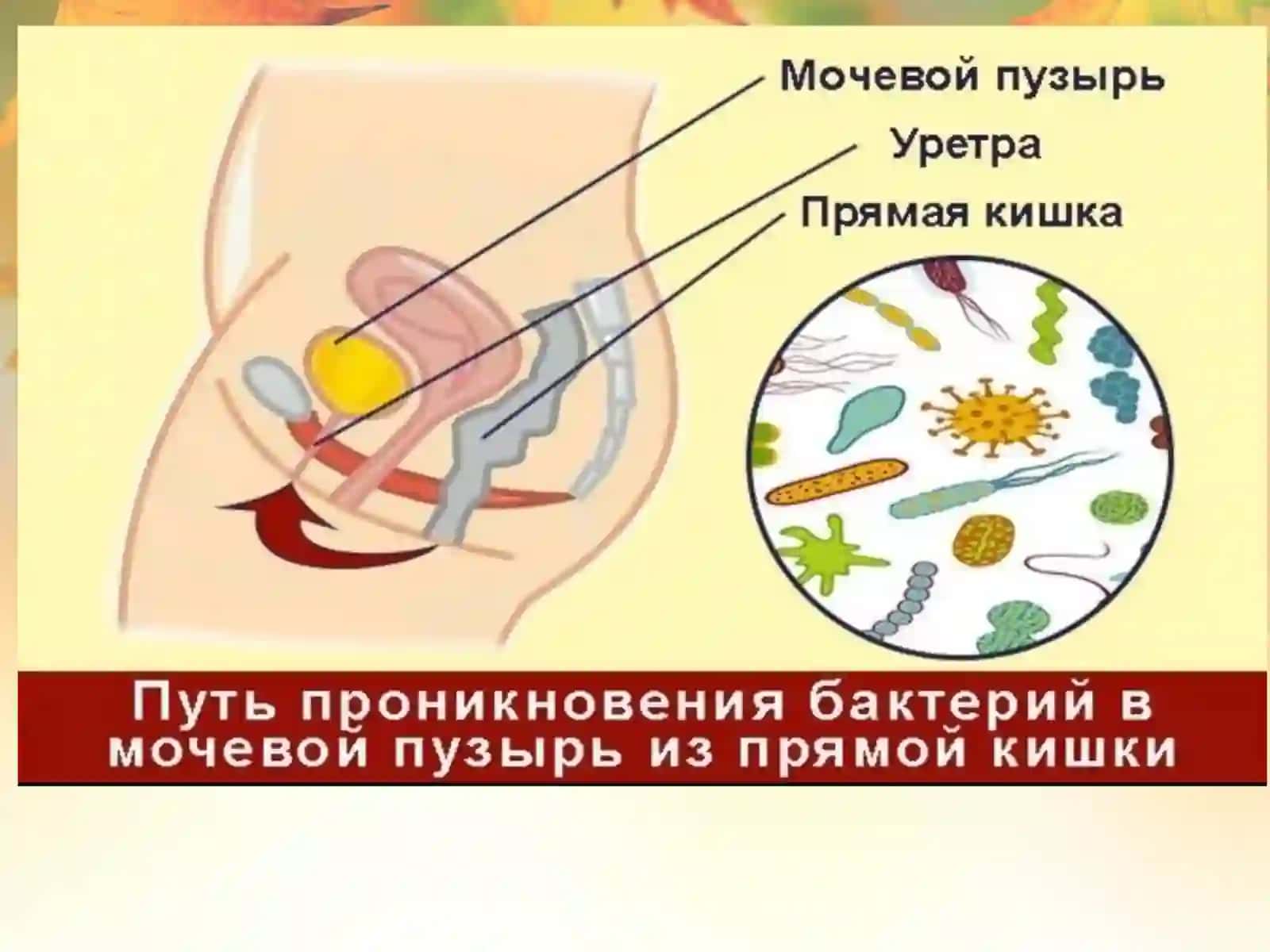 :  Siydik tanosil a’zolarining nospetsifik infeksion qo’zg’atuvchilari.Patogenezi.Labaratoriya tashxisi 4