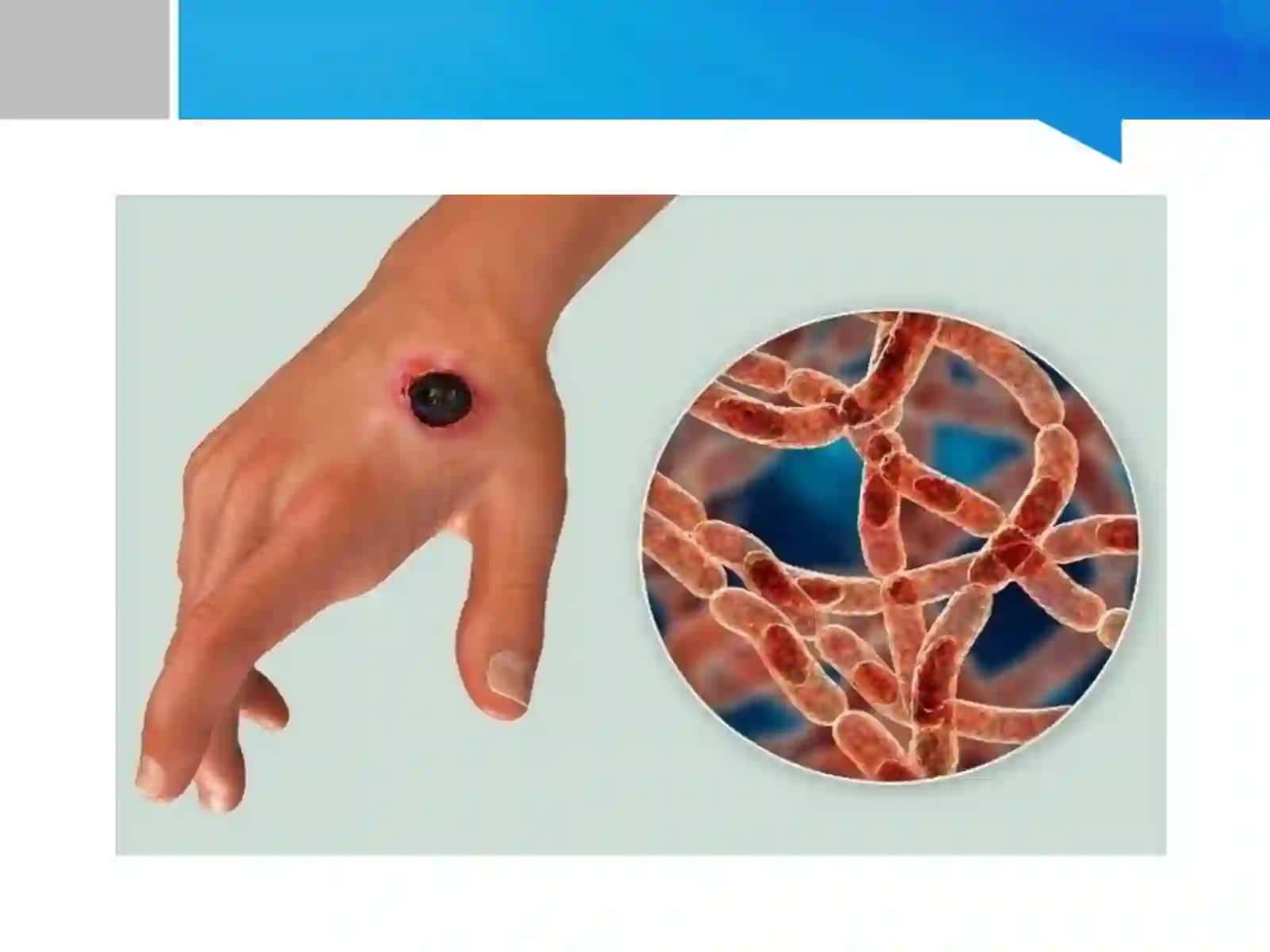kuydirgi kaslligida askoli reaksiyasi 4
