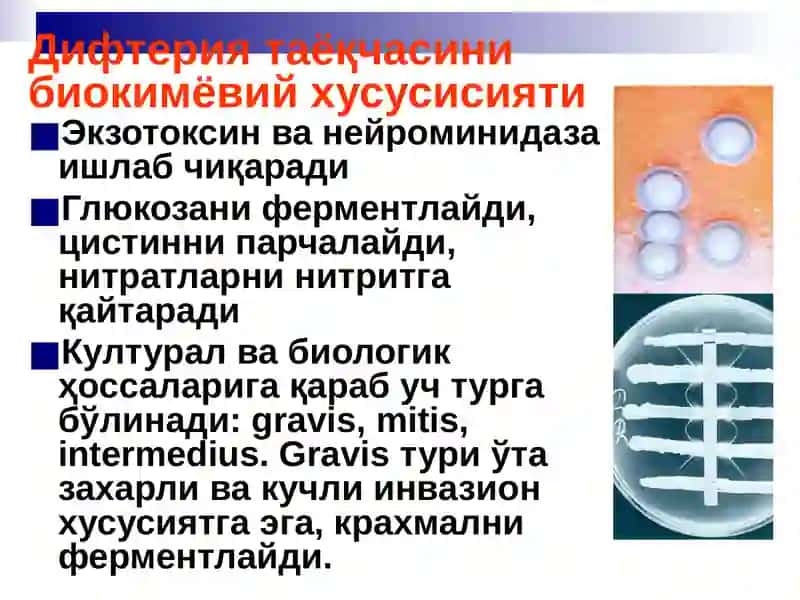 Бўғма – Дифтерия 4