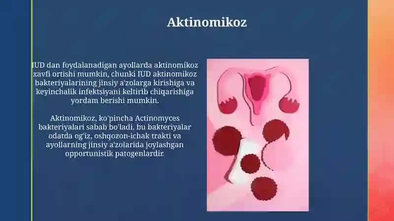 Ayollar jinsiy a’zolari spitsifik etialogyali yallig'lanish kasalliklari 4