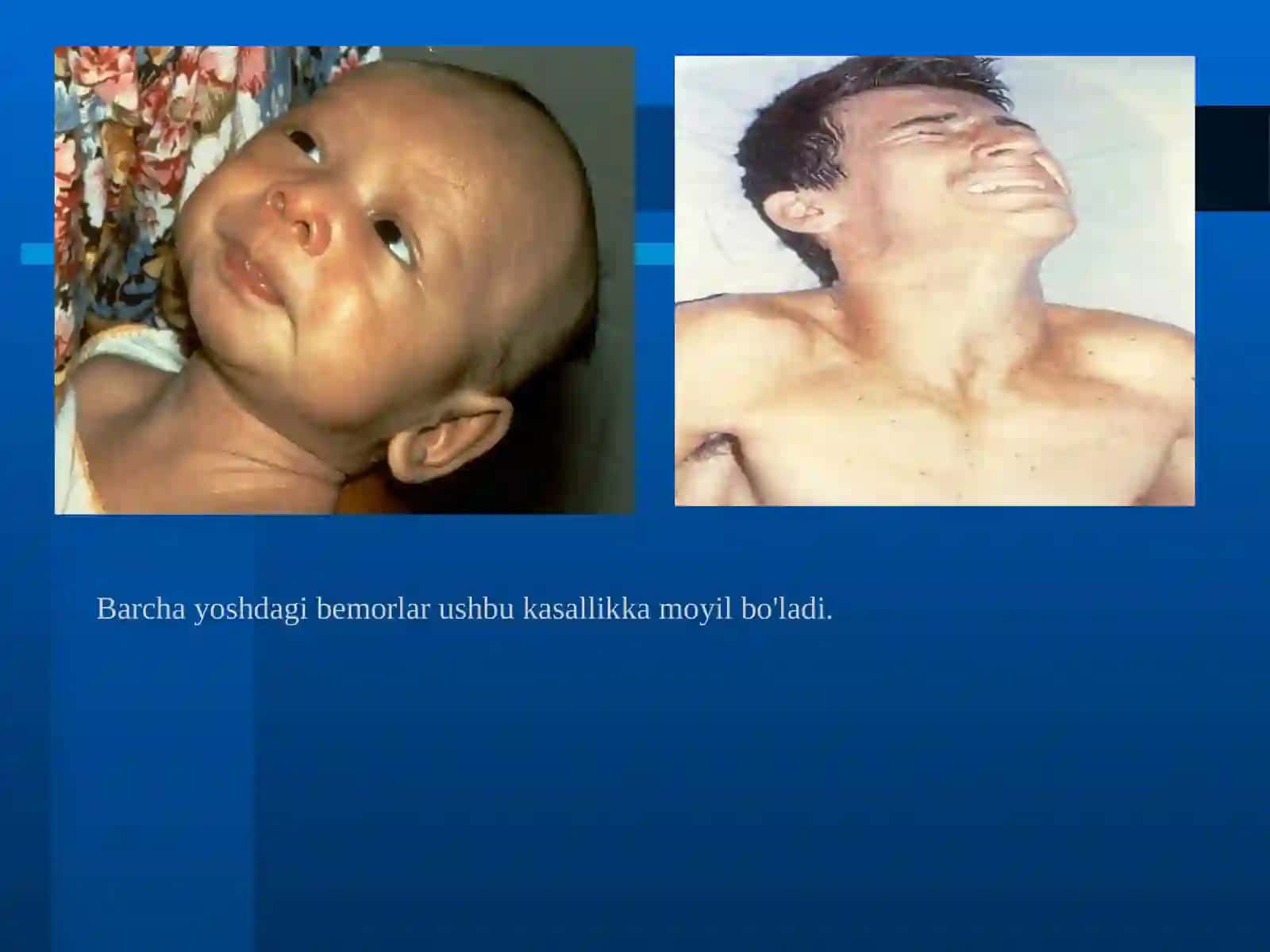 Qoqshol kasalligi va shoshilinch yordam 4