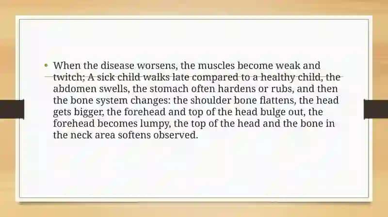 Rickets 4