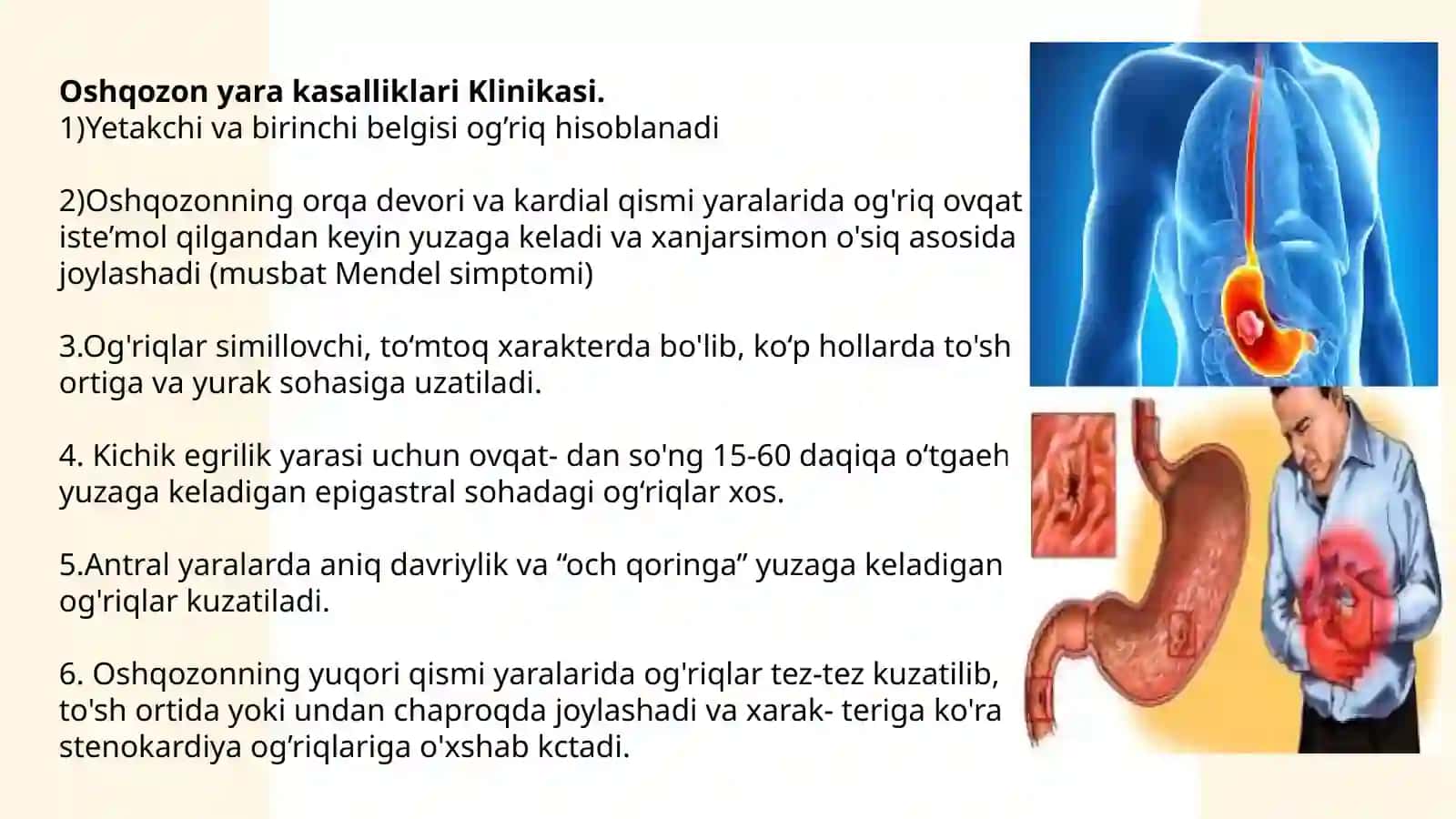 Oshqozon va o‘n ikki barmoqli ichak yara kasalligi asoratlari, diagnostikasi 4