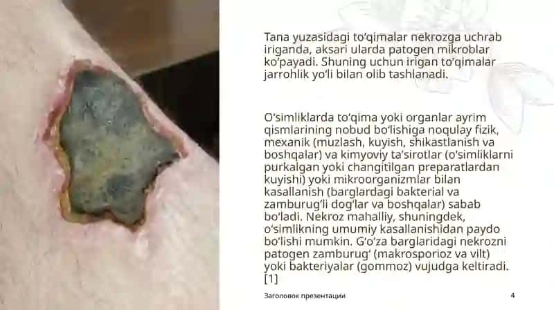 NEKROZ. NEKROZ VA APOPTOZNING FARQI 4