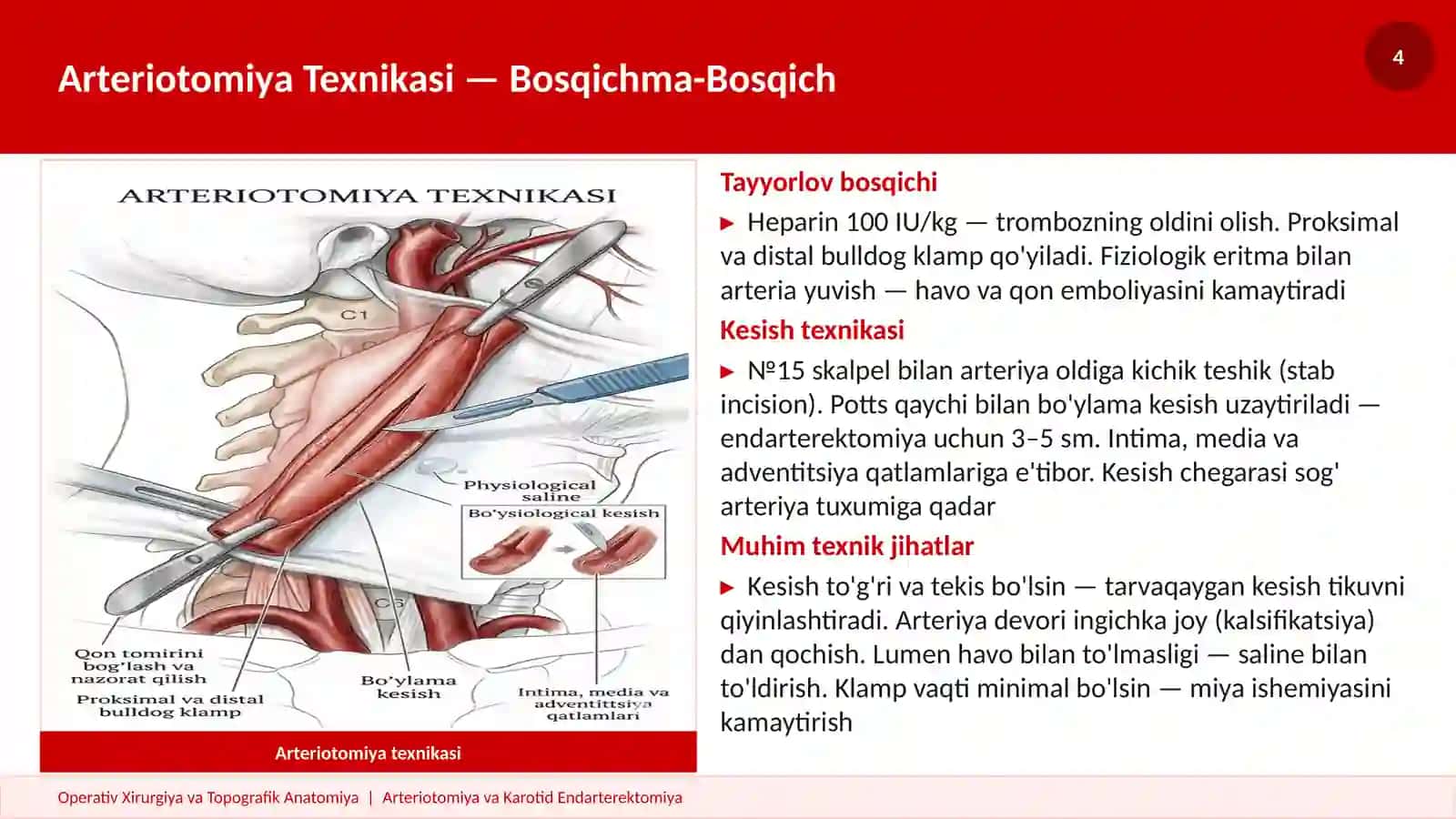 ARTERIOTOMIYA KAROTID PREZENTATSIYA 4