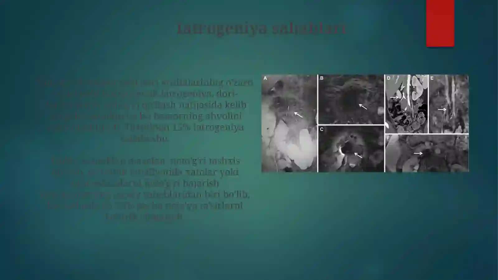 Yatrogeniyalar 4
