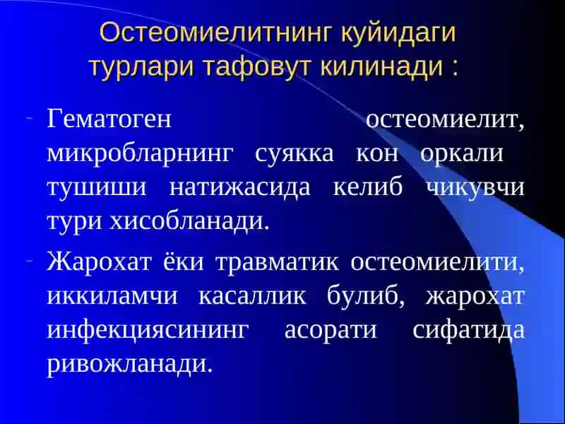 Остеомиелит 4
