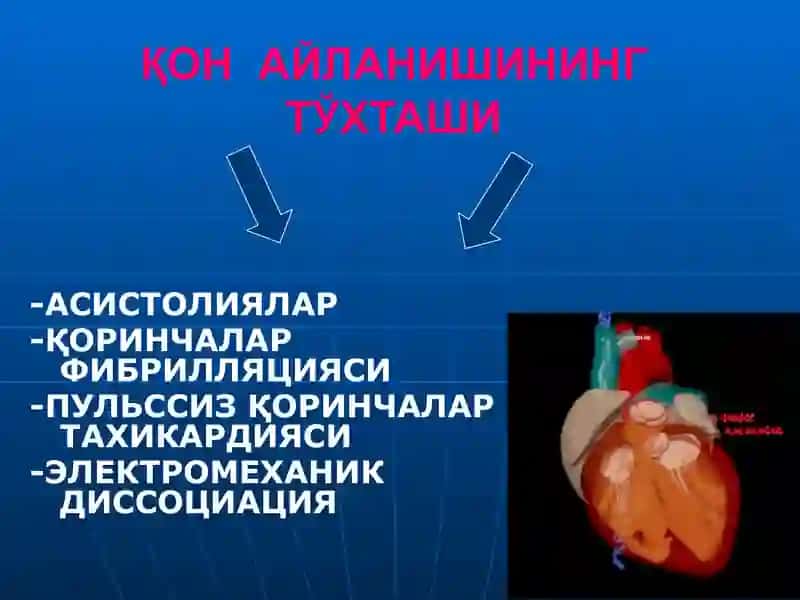 ЮРАК- ЎПКАРЕАНИМАЦИЯСИНИ ЎТКАЗИШ МУСТАҚИЛ ИШ 4