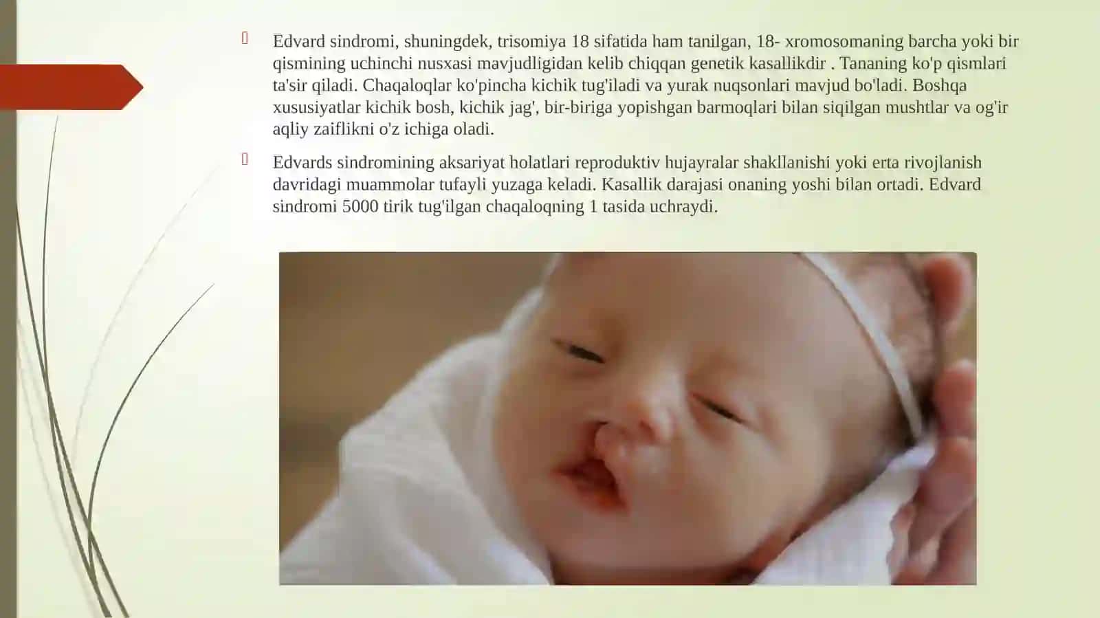 Irsiy kasalliklar 4