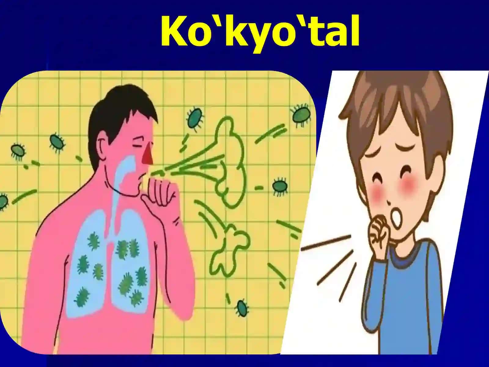 Ko'kyo'tal Parako'k yo'tal epidemiologiyasi 4