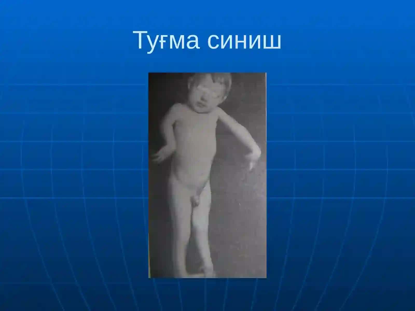 Суякларнинг синиши ва чикиши 4